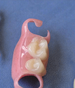 Гибкие зубные протезы: силиконовые. Съемные мягкие зубные протезы